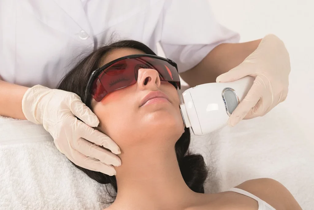 Skinpen Precision Microneedling - Demystifying Laser Hair Removal - Med Spa Treatments - LaserSkin MedSpa